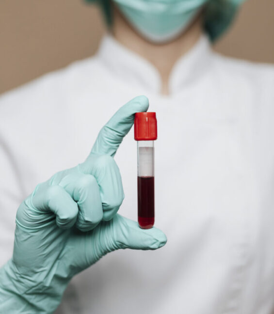 Nurse holding a blood test tube